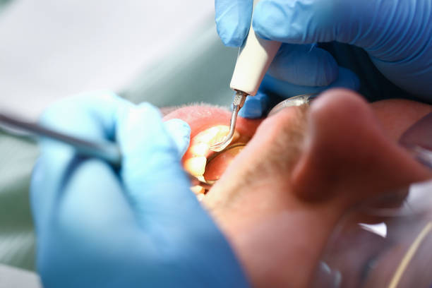 Best Pediatric Emergency Dentist in Carson, WA