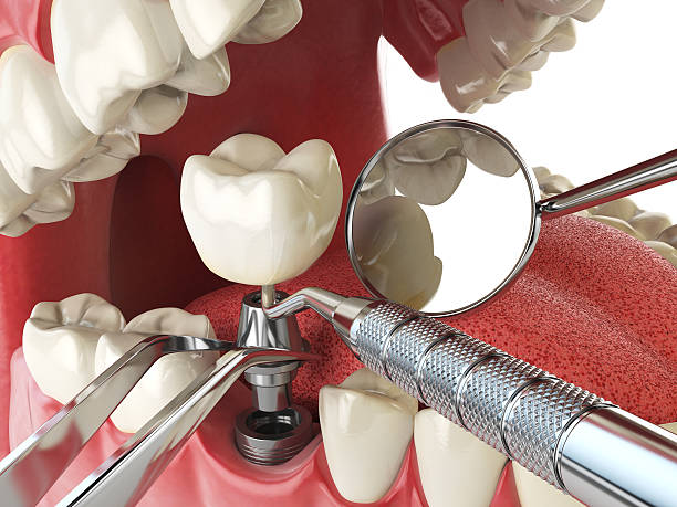 Best Emergency Gum Treatment in Carson, WA